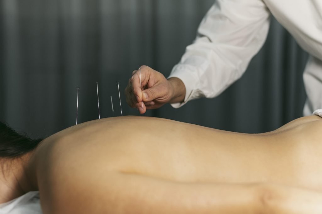 Acupuncturist in Oosterhout